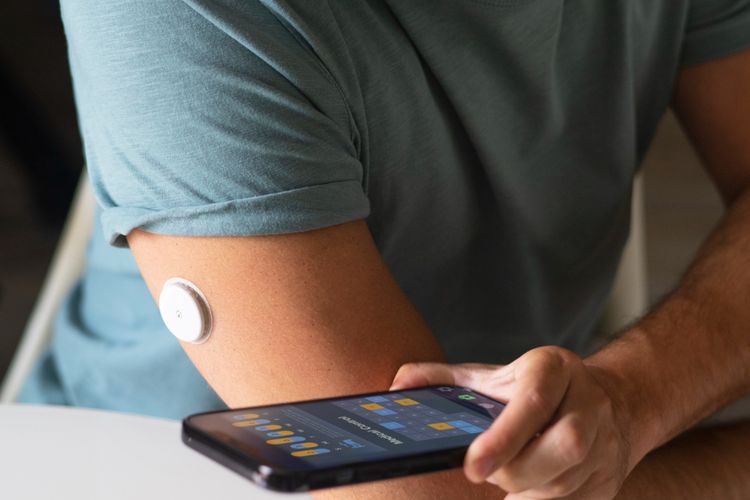 Ilustrasi pemakaian continuous glucose monitors atau alat pemantau kadar gula darah.