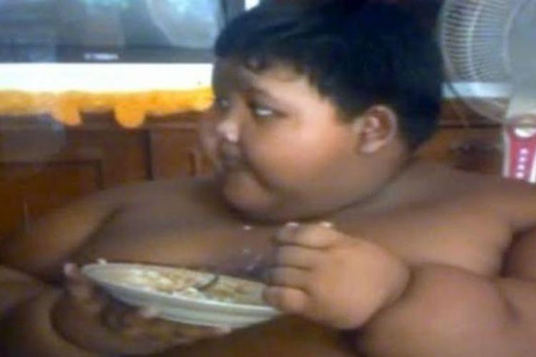 Arya Permana, bocah berusia 10 tahun asal Cipurwasari, Karawang, Jawa Barat, memiliki berat hingga 140 kilogram.