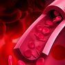 Memahami Gejala Hemoglobin Rendah dan Cara Mengatasinya