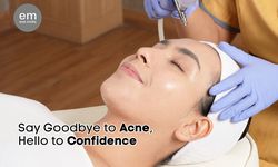 Atasi Jerawat Membandel dengan 4 Treatment Kulit Ini