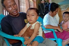 Mengidap Tumor di Hidung, Bocah 10 Bulan di Kabupaten Manggarai Butuh Bantuan Biaya Berobat