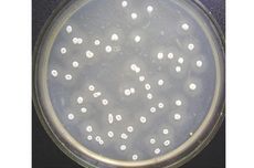 Tetrasiklin, Antibiotik yang Dihasilkan Streptomyces aureofaciens