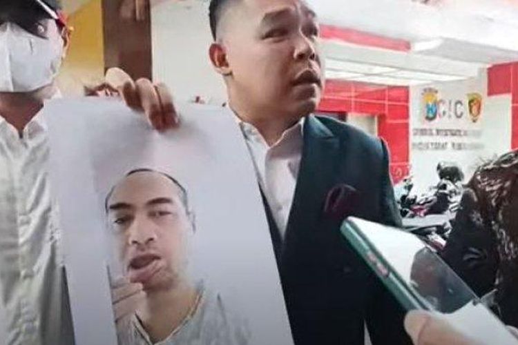Ferry Irawan diperiksa sebagai tersangka kasus KDRT terhadap Venna Melinda di Polda Jatim. Ia membawa barang bukti berupa foto yang memperlihatkan bibirnya robek akibat dicakar. 
