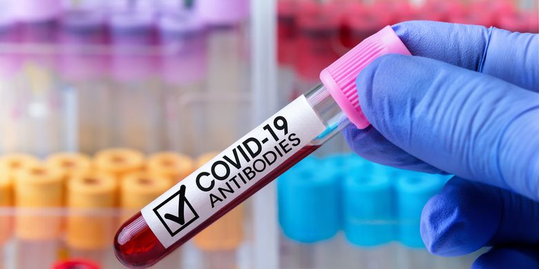 Ilustrasi tes antibodi terhadap SARS-CoV-2. Ilmuwan menemukan cara deteksi antibodi Covid-19 yang lebih cepat dan akurat hanya dengan sampel air liur.