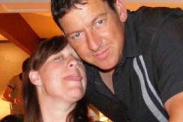 Samantha Lamb dan suaminya Andy Lamb saat difoto pada 2009 sebelum operasi dilakukan. 