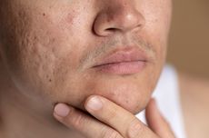 Selain Nadiem, Ini Daftar Pihak Diperkaya di Kasus Korupsi Laptop Rp 2,1 T