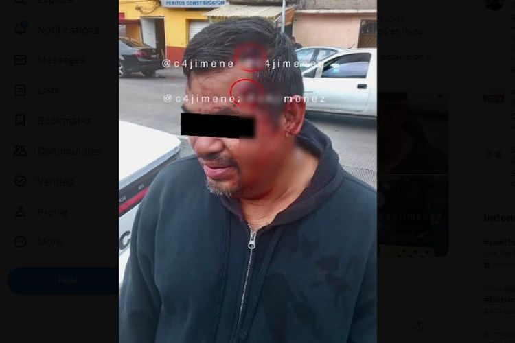 Kepala seorang pria asal Meksiko ditembak dua kali, tetapi terpantul dan hanya menyisakan luka kecil.