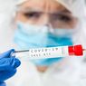 FDA Peringatkan, Hasil Tes Antigen Covid-19 Bisa Positif Palsu