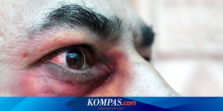 Apa Itu Jamur Hitam? Kenali Gejala, Bahaya, hingga Penanganannya - Vimarsana News