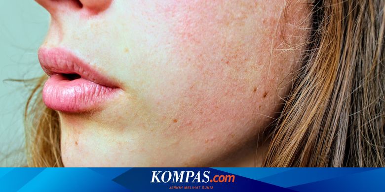 Berita Harian Ciri-ciri-wajah-terkena-merkuri Terbaru Hari Ini - Kompas.com