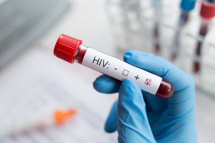 Ilustrasi HIV/AIDS, gejala awal HIV, ciri-ciri HIV, gejala HIV, gejala klinis HIV menurut WHO, tahap HIV.