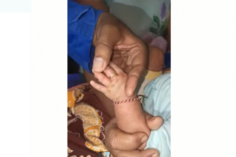 Tangkapan layar cuplikan video petugas Damkar Deli Serdang yang memotong cincin ketat dari bayi berusia 2 tahun.