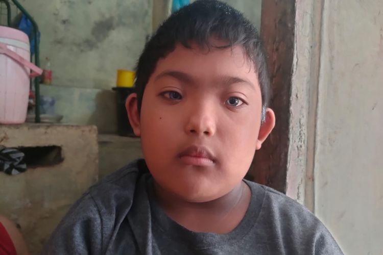 Ketut Adi (9), bocah bermata biru asal Kelurahan Kendran, Kecamatan Buleleng, Kabupaten Buleleng, Provinsi Bali.