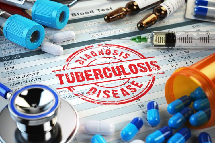 Ilustrasi tuberculosis (TBC)