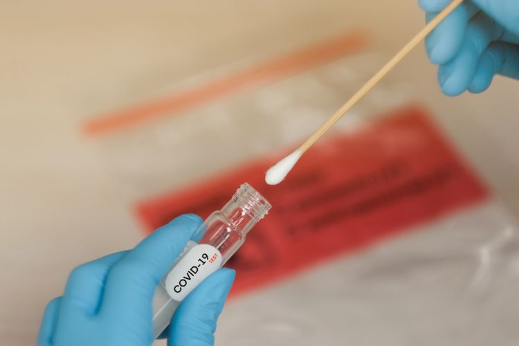 Ramai Soal Rapid Test Antigen Ini Penjelasan Lengkap Kemenkes Dari Het Hingga Persoalan Sanksi Halaman All Kompas 