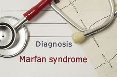 Sindrom Marfan
