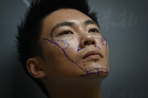 Ingin Peluang Hidup Lebih Baik, Pria Muda China Memilih Permak Wajah