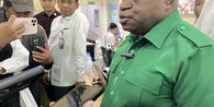 Jenguk Korban Keracunan MBG, Pigai: Kalau Sudah Sembuh Kembali Sekolah Biar Bisa Jadi Menteri Seperti Saya
