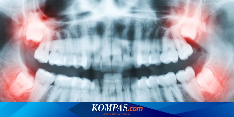 7 Organ Vestisial Manusia yang Tidak Dibutuhkan Tubuh, Apa Saja? - Vimarsana News