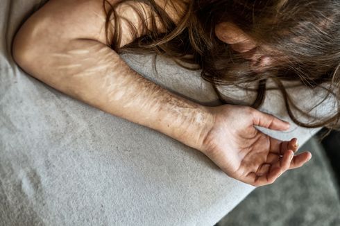 5 Hal yang Perlu Dikatakan pada Orang dengan Kecenderungan Self Harm