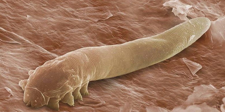 Tungau jenis Demodex folliculorum yang banyak tinggal di wajah manusia. 