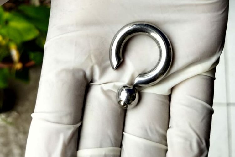 Cincin logam yang berhasil dilepas dari penis MRZ (25) oleh petugas pemadam kebakaran Kabupaten Blitar, Selasa (1/3/2022)