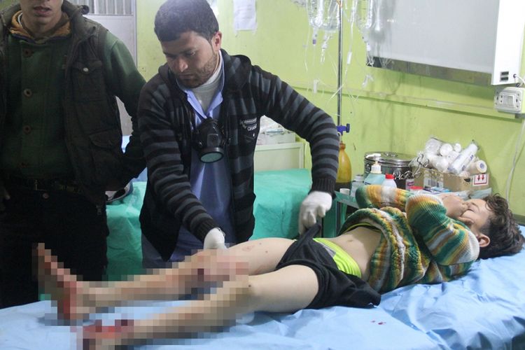 Seorang bocah yang terluka ditangani di sebuah rumah sakit di Khan Sheikhun, kota yang dikuasai kelompok pemberontak di Provinsi Idlib, Suriah barat laut, Selasa (4/4/2017), menyusul serangan yang diduga mengandung gas beracun. Sedikitnya 72 orang tewas, termasuk 20 anak-anak akibat serangan senjata kimia tersebut.