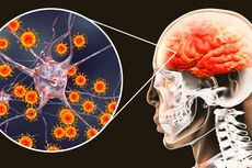 Kenali Apa Itu Meningitis, Penyebab, dan Gejalanya