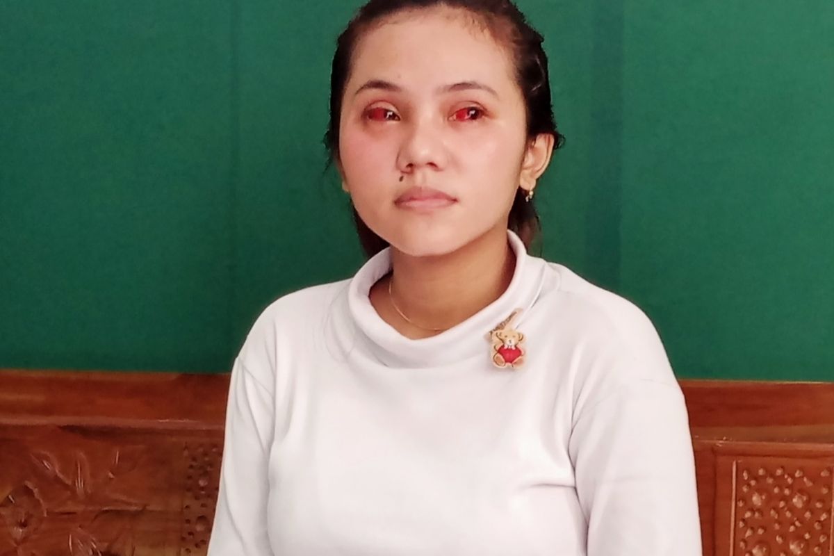 Kevia Naswa Ainur Rohma (18), Aremanita yang selamat dari tragedi di Stadion Kanjuruhan.