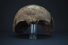 Berusia 5.000 Tahun, Ini Korban Wabah Tertua yang Pernah Ditemukan