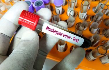 Mutasi Virus Cacar Monyet Diduga Lebih Cepat dari Perkiraan ...