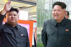 Pria China Operasi Plastik agar Wajahnya Mirip Kim Jong Un