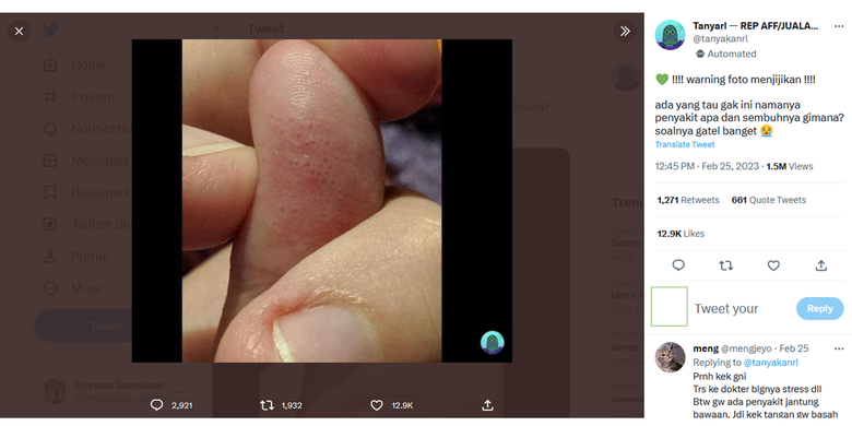 Foto yang menampilkan bagian telapak jari mencuri perhatian warganet di Twitter.