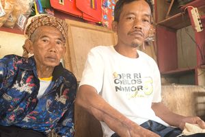 Kisah Junaedi Dipatuk Ular Gibug, Jalani Cangkok Kulit dan Tak Bisa Berobat Lagi