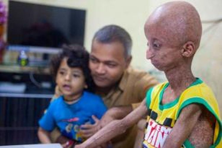 Nihal (14), remaja asal Mumbai, India, penderita Hutchinson-Gilford Progeria Syndrome (HGPS) atau sindrom progeria (penuaan dini).
