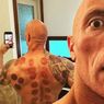 The Rock Pun Mencobanya, Apa itu Terapi Bekam?