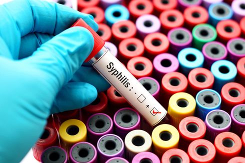 Kasus Sifilis Naik 70 Persen, Pakar UM Jelaskan 3 Cara Pencegahan