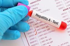 Infeksi Hepatitis A Sangat Mirip dengan Hepatitis Akut Misterius Anak