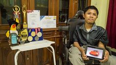 Kisah Perjuangan Husein dari UGM, Berprestasi dari Kursi Roda 