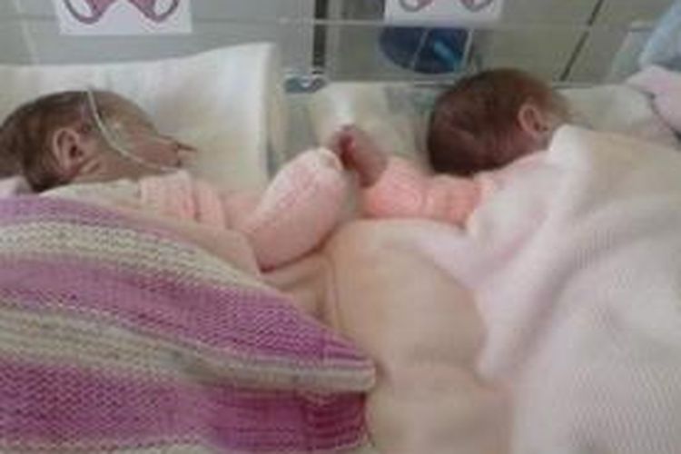 Bayi kembar yang lahir prematur berpegangan tangan saat bersama dalam inkubator.