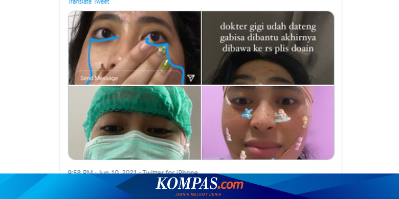 Viral, Kisah Rahang Tak Bisa Menutup Setelah Menguap, Apa Penyebabnya?