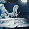 Robot Medis Pertama Lakukan Operasi Realistis Secara Mandiri dengan Akurasi 100 Persen