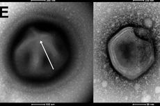 Apakah Virus Kuno dari Permafrost yang Dihidupkan Lagi Berbahaya?