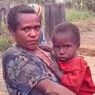 83 Anak di Papua Tengah Terkena Campak dan 15 di Antaranya Meninggal Dunia