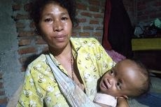 Kisah Pilu Bocah 1 Tahun di Manggarai Barat Idap Hidrosefalus, Keluarga Tak Punya Biaya Berobat