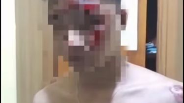 Niat Hati Bawa Kabur Motor Curian, Pemuda di Bogor Alami Nasib Sial Saat lewat Parung Panjang