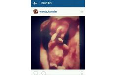 Wanda Hamidah Pamerkan Foto USG Bayi dalam Kandungannya