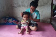 Pilunya Apriani, Bocah 1 Tahun Penderita Hidrosefalus yang Butuh Dana Berobat ke Bali