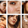 5 Beauty Influencer Tunjukkan Cara Cintai Kulit Meski Tak Sempurna