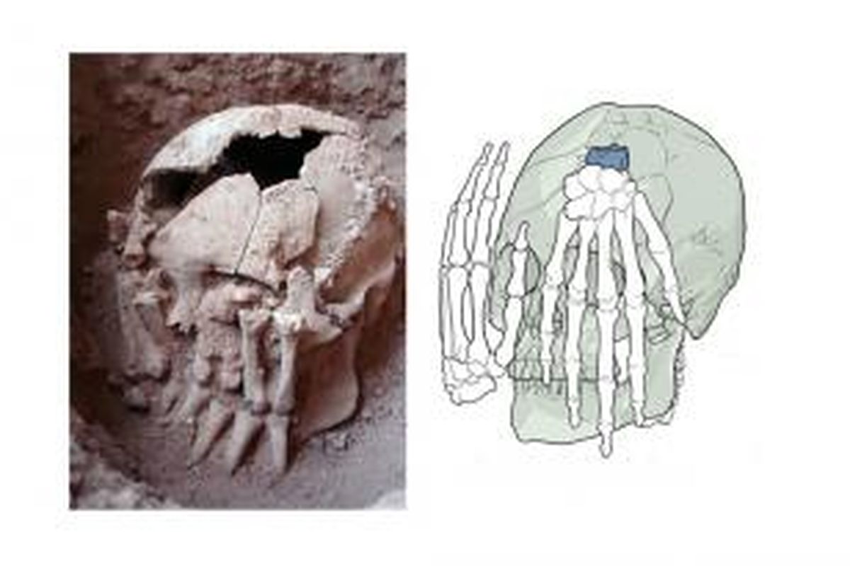 Tengkorak ini menjadi bukti tertua kasus pemenggalan kepala manusia 9.000 tahun lalu. 